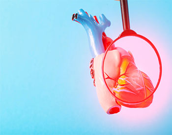 Medical mock-up of a heart under a magnifying glass on a blue background. Heart disease concept, inflammation of the heart muscle, myocardial infarction, coronary heart disease.